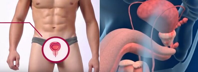 Prostatita la barbati, recunoscuta dupa anumite semne